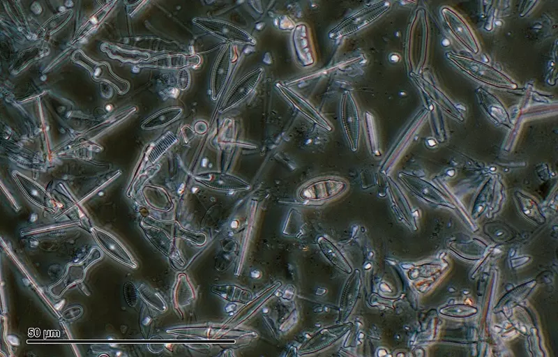 Structure de la terre de diatomée au microscope.